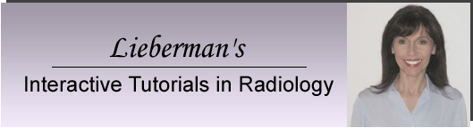 Tutorials in Radiology